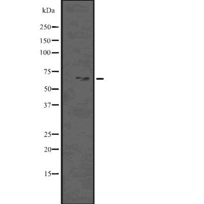 Phospho-Beclin 1 (Ser93,Ser96) Antibody in Western Blot (WB)