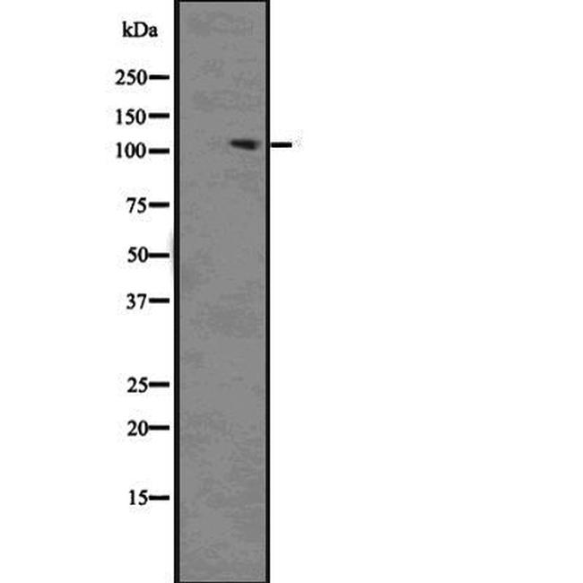 Phospho-ACK1 (Tyr859, Tyr860) Antibody in Western Blot (WB)