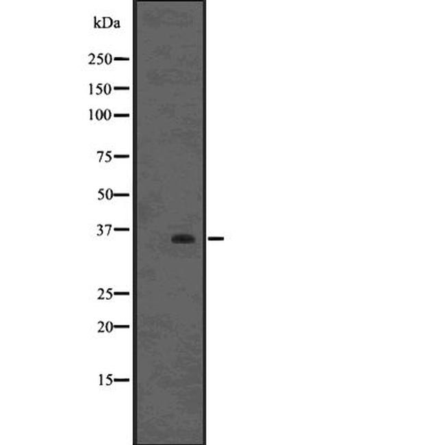 FOXE1 Antibody in Western Blot (WB)