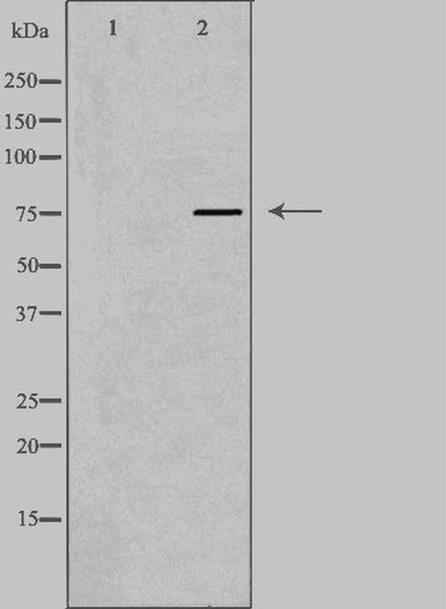 AKAP8 Antibody in Western Blot (WB)