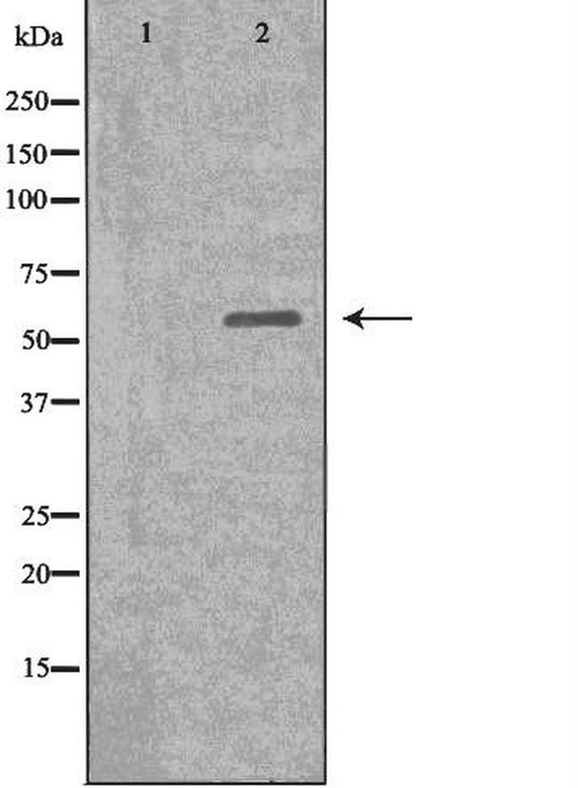 DKC1 Antibody in Western Blot (WB)