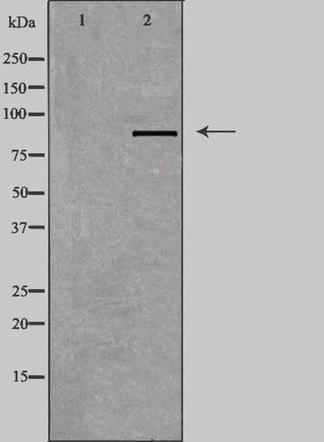 TACC1 Antibody in Western Blot (WB)