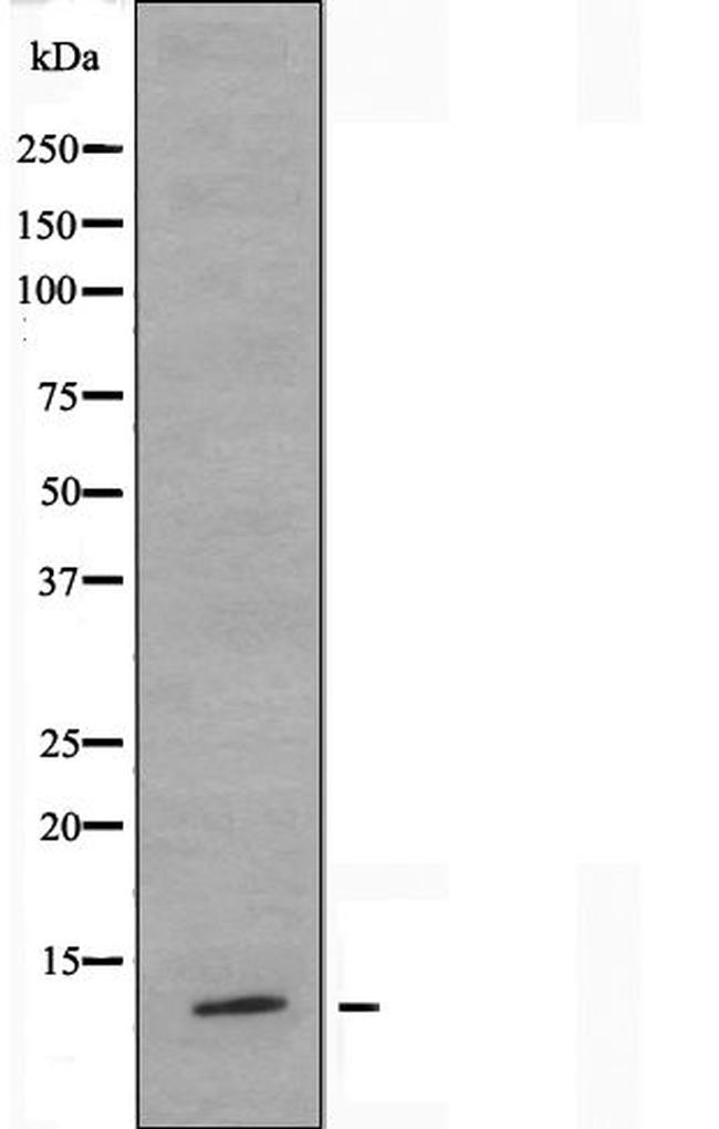 TUSC2 Antibody in Western Blot (WB)