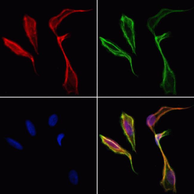 PFKFB1 Antibody in Immunocytochemistry (ICC/IF)