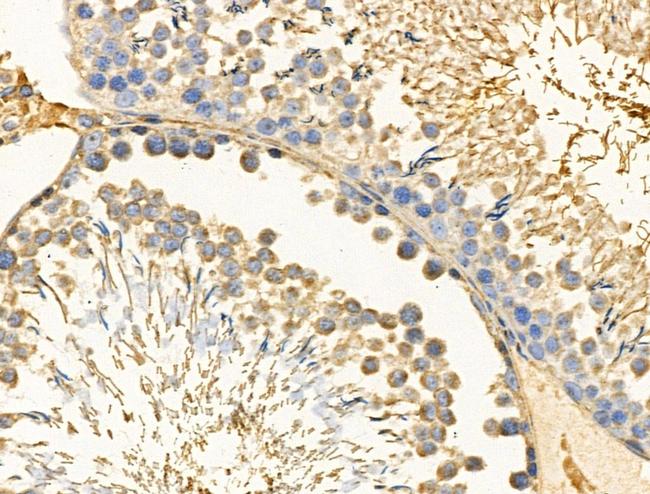 PFKL Antibody in Immunohistochemistry (Paraffin) (IHC (P))