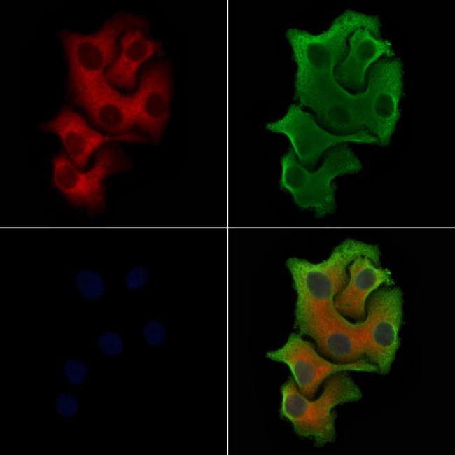 ITPKA Antibody in Immunocytochemistry (ICC/IF)