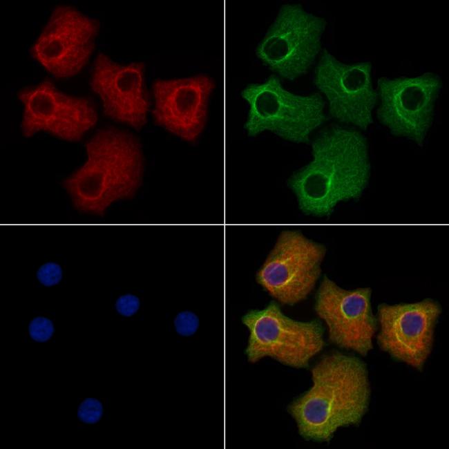 DTYMK Antibody in Immunocytochemistry (ICC/IF)