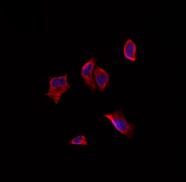 AKAP5 Antibody in Immunocytochemistry (ICC/IF)