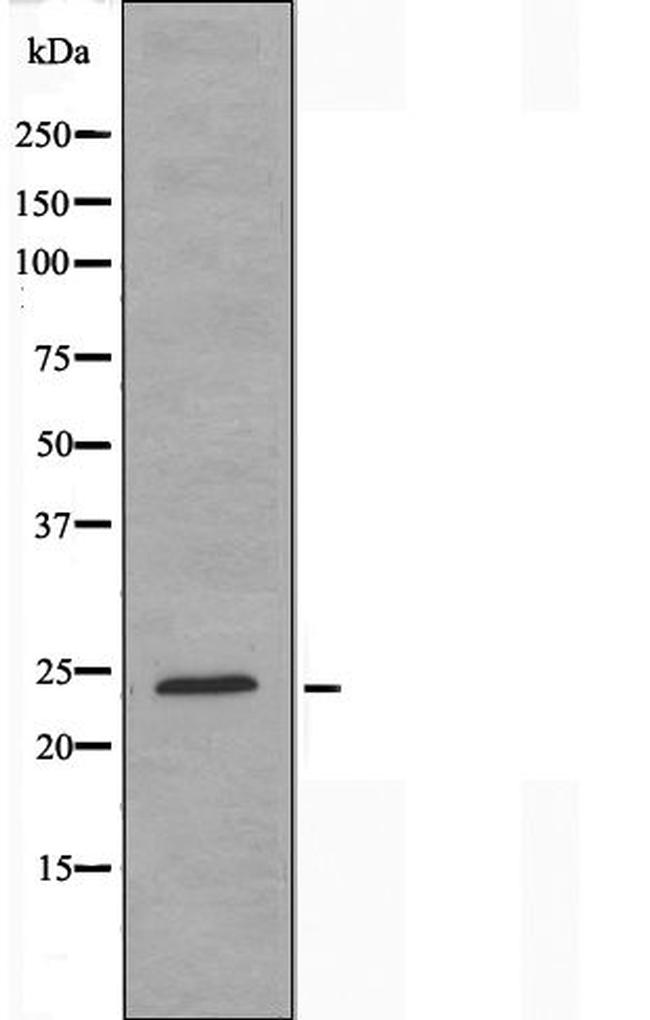 RPL10 Antibody in Western Blot (WB)