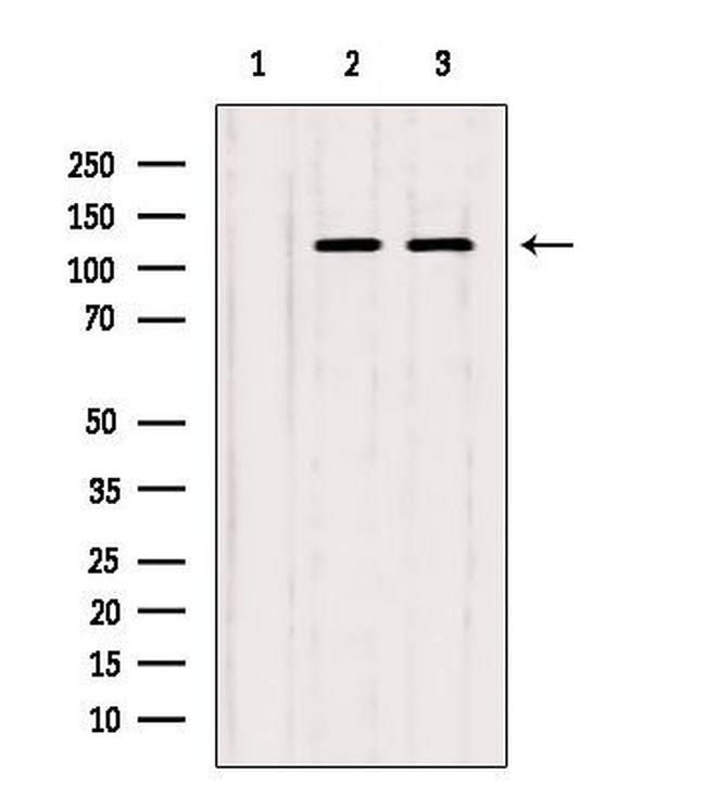 ITPKB Antibody in Western Blot (WB)