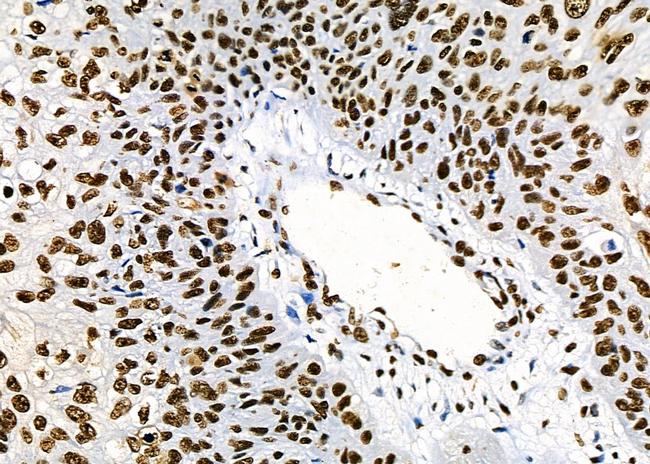 PRKAR1B Antibody in Immunohistochemistry (Paraffin) (IHC (P))