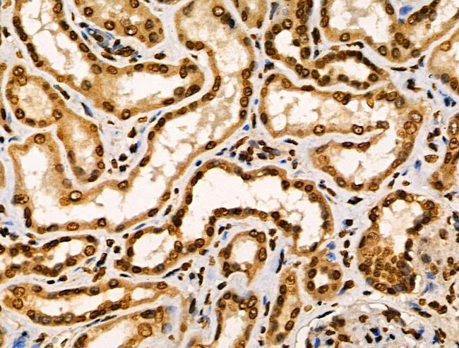 CIITA Antibody in Immunohistochemistry (Paraffin) (IHC (P))