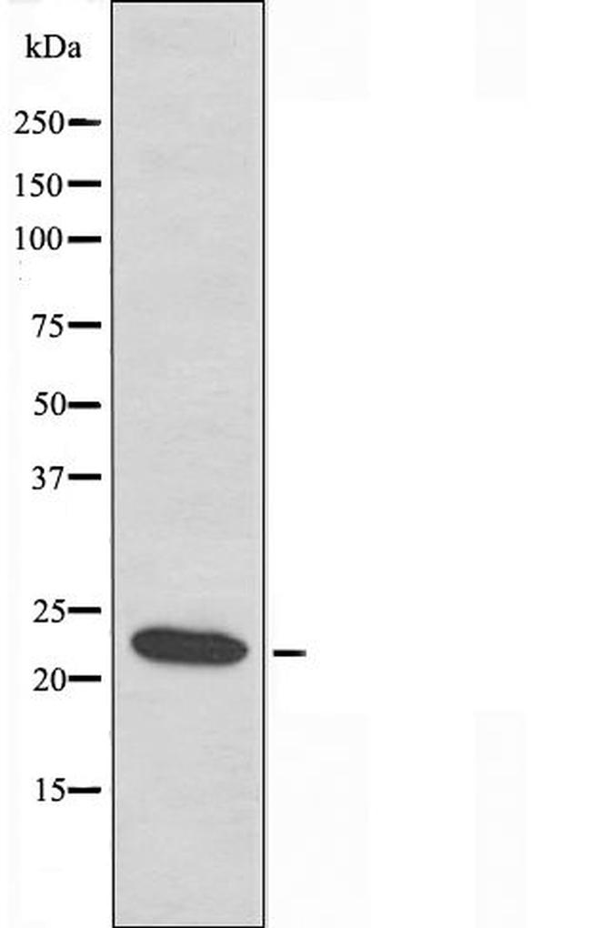 ID4 Antibody in Western Blot (WB)