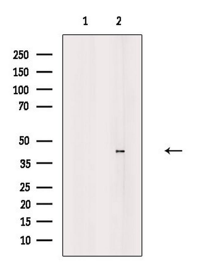 TIS11D Antibody in Western Blot (WB)