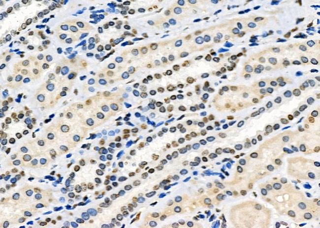 HOXA1 Antibody in Immunohistochemistry (Paraffin) (IHC (P))