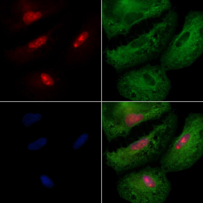 IRX1 Antibody in Immunocytochemistry (ICC/IF)