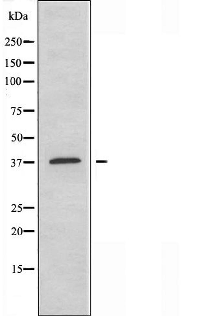 MEF2B Antibody in Western Blot (WB)