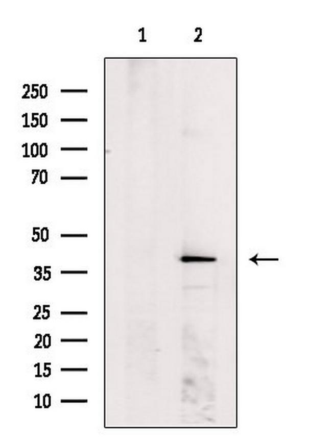 MVK Antibody in Western Blot (WB)