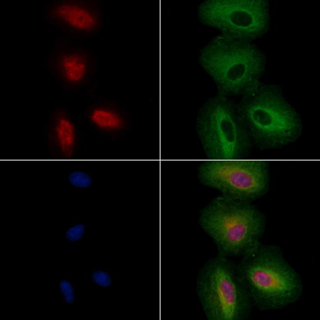 FOXC1/FOXC2 Antibody in Immunocytochemistry (ICC/IF)