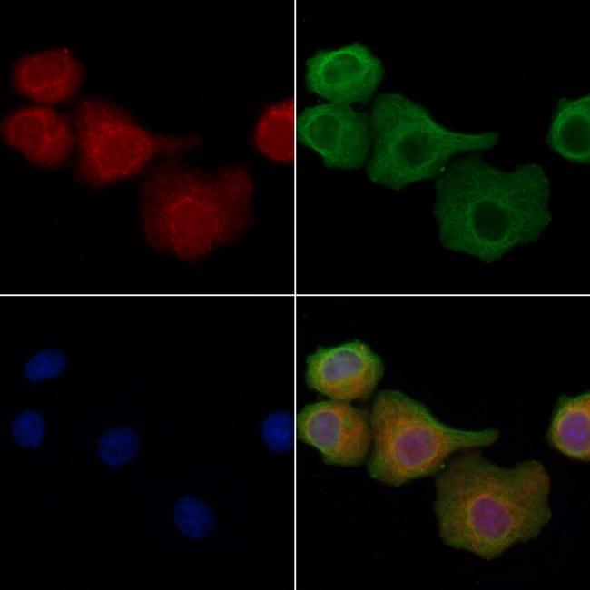 JIP2 Antibody in Immunocytochemistry (ICC/IF)