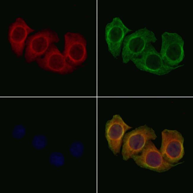 p35 Antibody in Immunocytochemistry (ICC/IF)