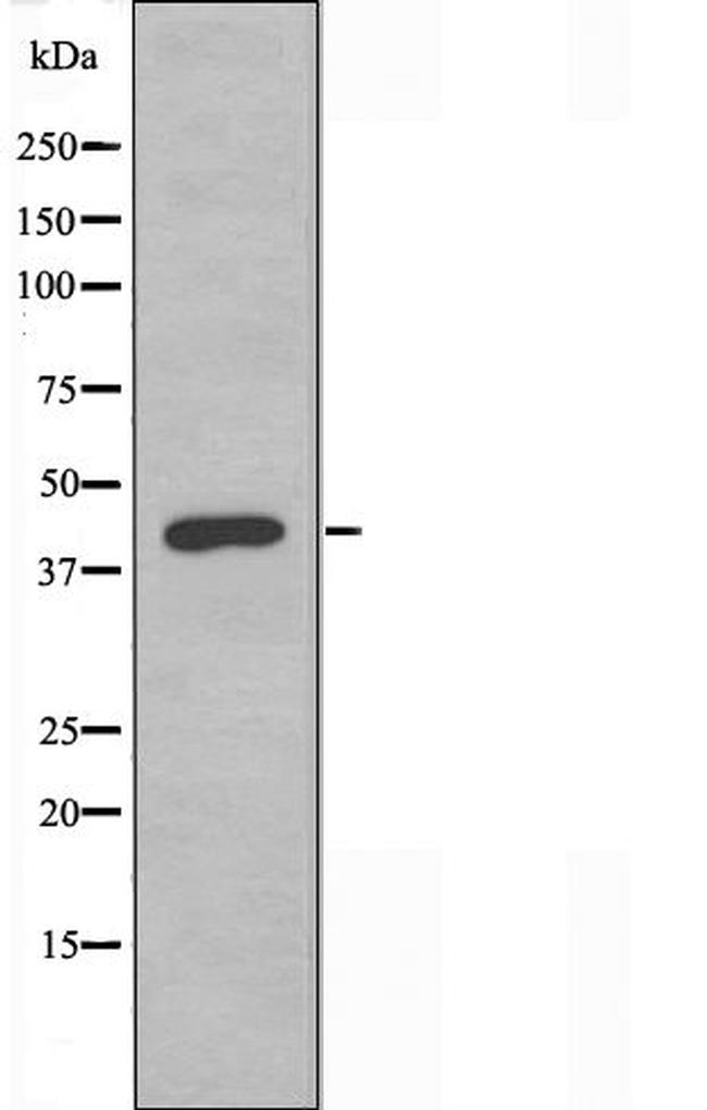 MAPKAPK3 Antibody in Western Blot (WB)