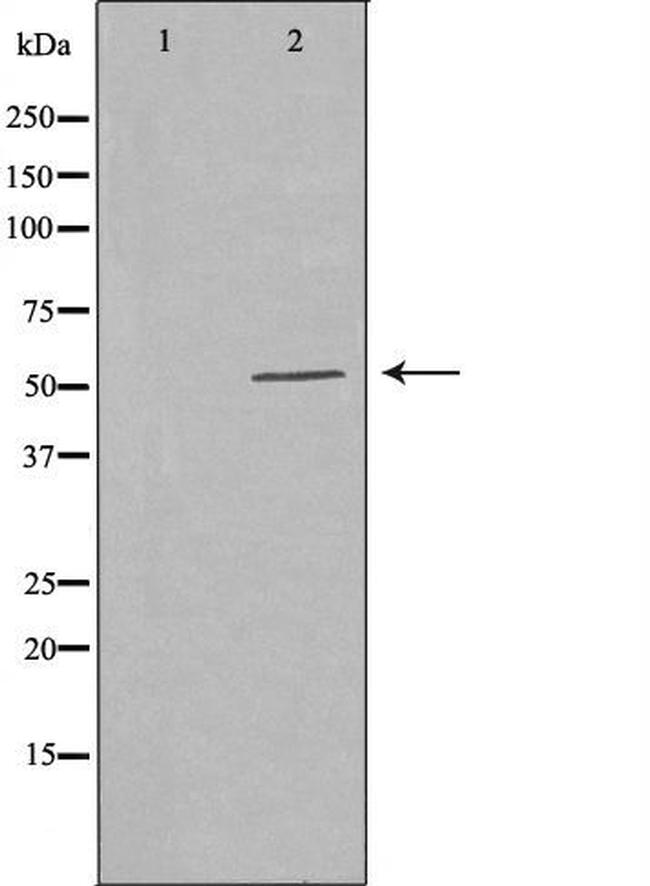 PFKFB1/PFKFB4 Antibody in Western Blot (WB)