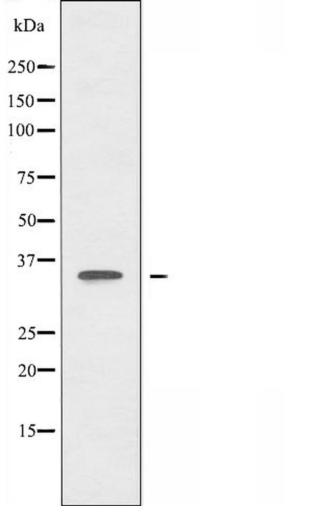 CTU1 Antibody in Western Blot (WB)