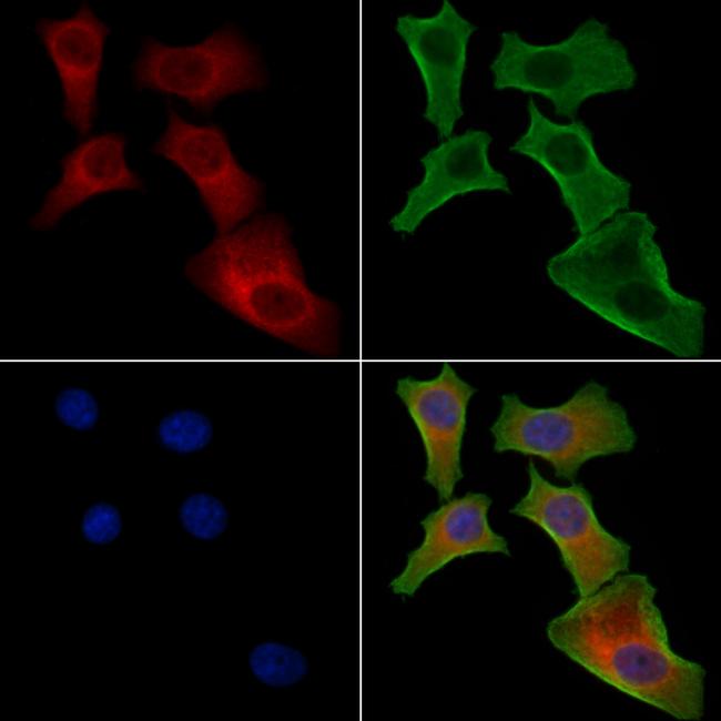 EPS8L1 Antibody in Immunocytochemistry (ICC/IF)