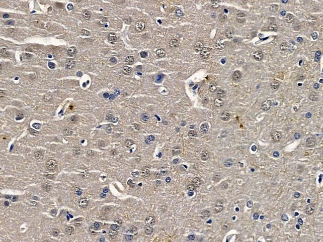 CUGBP1 Antibody in Immunohistochemistry (Paraffin) (IHC (P))