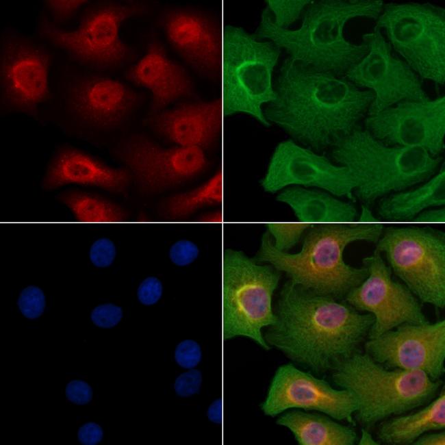 FOXB1/FOXB2 Antibody in Immunocytochemistry (ICC/IF)