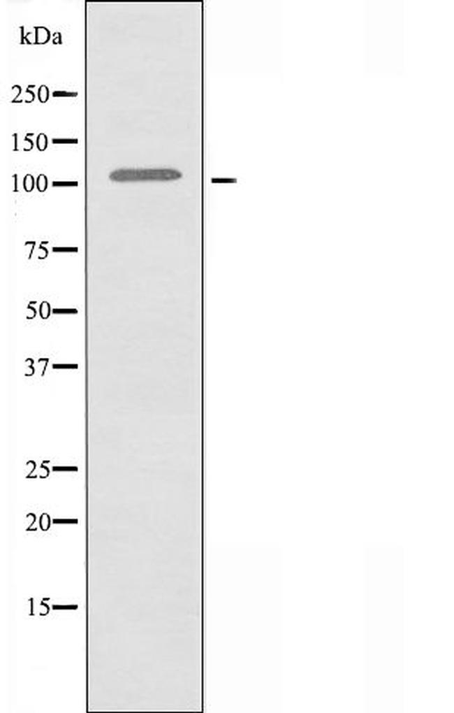 XRN2 Antibody in Western Blot (WB)