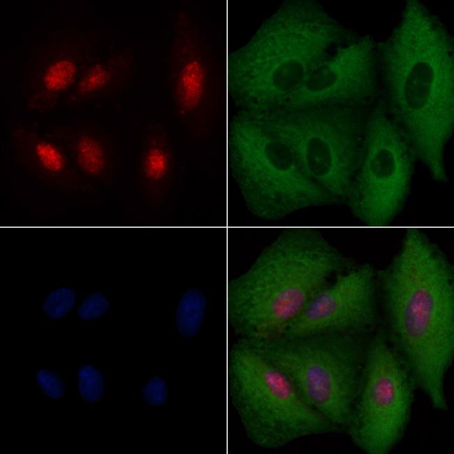 BRMS1 Antibody in Immunocytochemistry (ICC/IF)