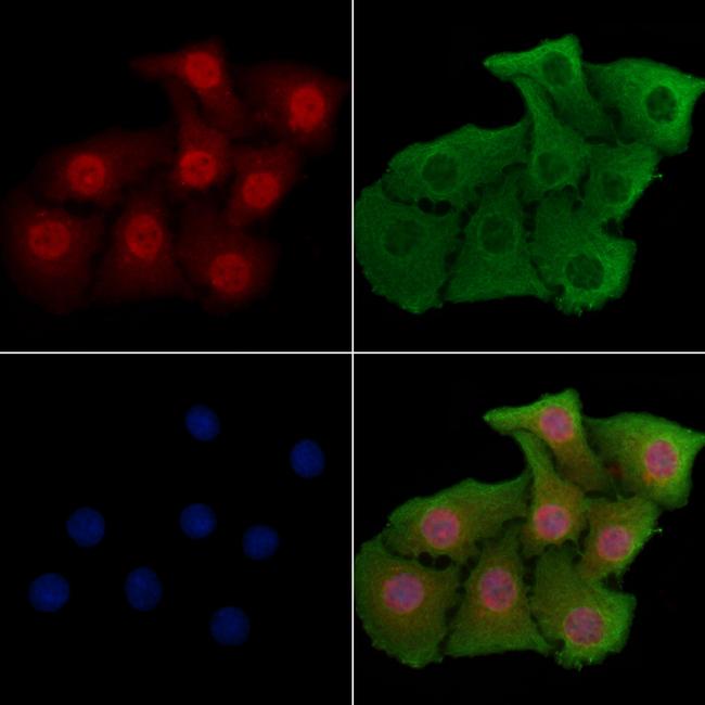 YBX2 Antibody in Immunocytochemistry (ICC/IF)