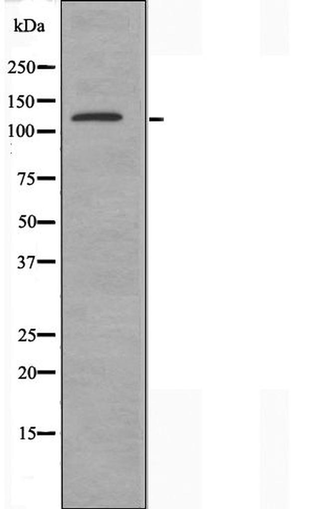 Adenylate Cyclase 5/6 Antibody in Western Blot (WB)