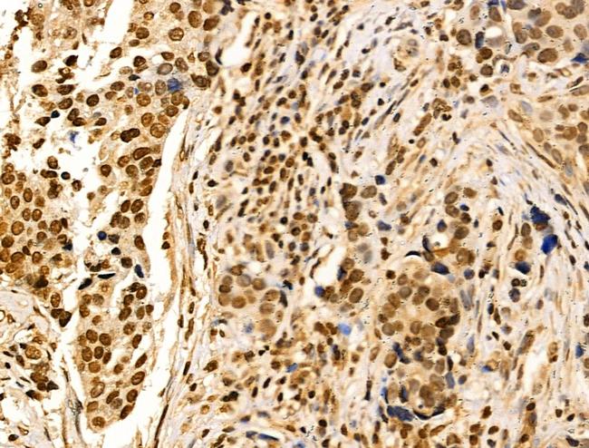 CDCA2 Antibody in Immunohistochemistry (Paraffin) (IHC (P))