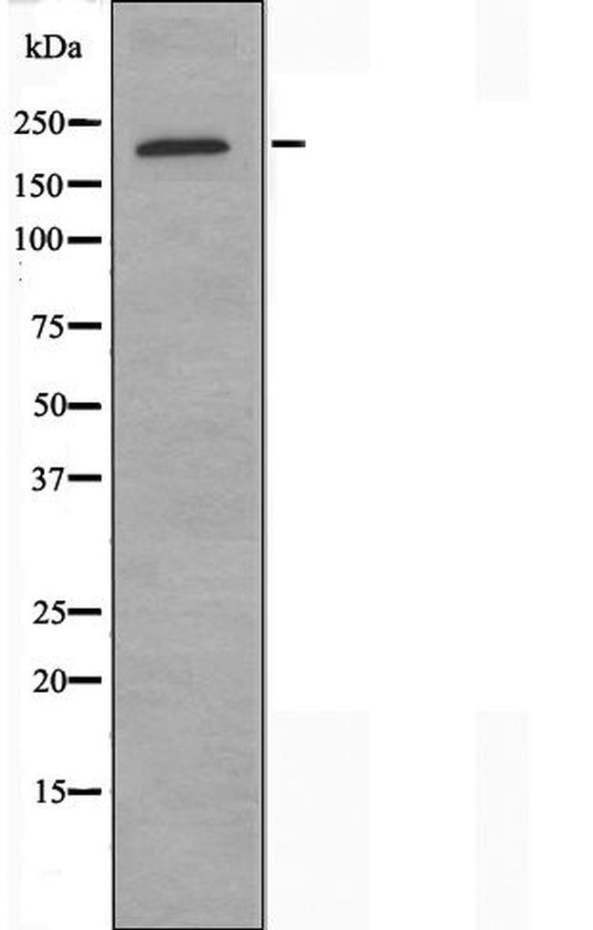 COL11A1 Antibody in Western Blot (WB)