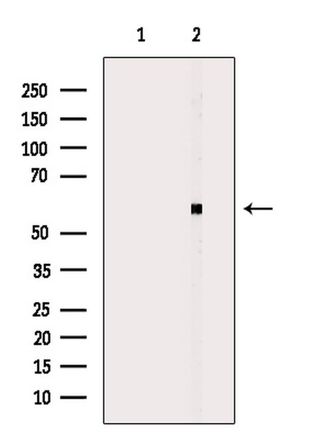 CYP2W1 Antibody in Western Blot (WB)