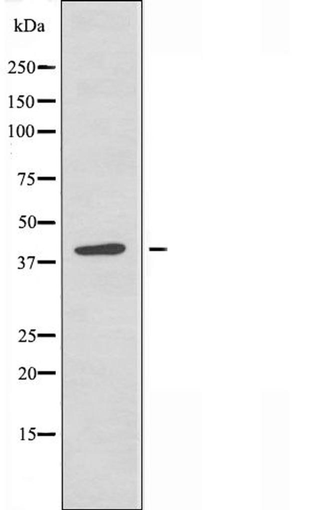 RAD51D Antibody in Western Blot (WB)