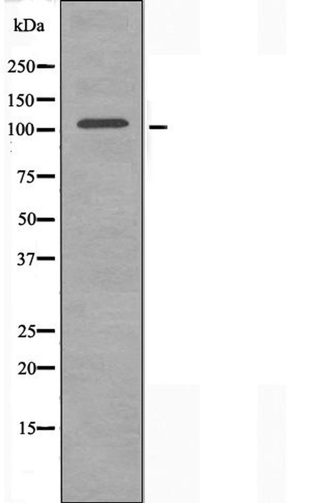 ORC1 Antibody in Western Blot (WB)