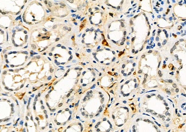 AGPAT3 Antibody in Immunohistochemistry (Paraffin) (IHC (P))