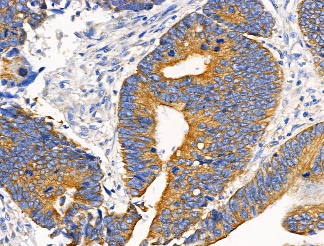 HSD3B7 Antibody in Immunohistochemistry (Paraffin) (IHC (P))