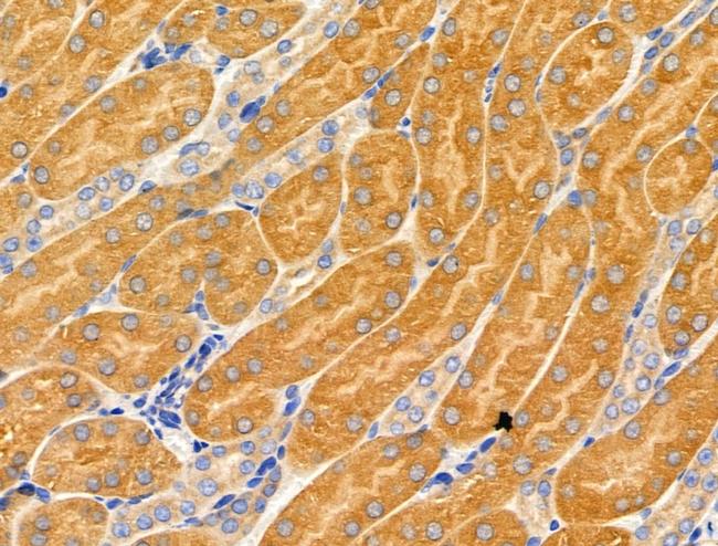 MRPL16 Antibody in Immunohistochemistry (Paraffin) (IHC (P))