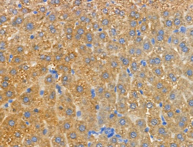 MRPL20 Antibody in Immunohistochemistry (Paraffin) (IHC (P))