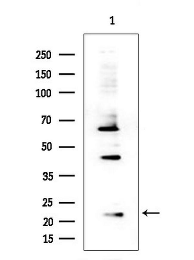 RPS15 Antibody in Western Blot (WB)