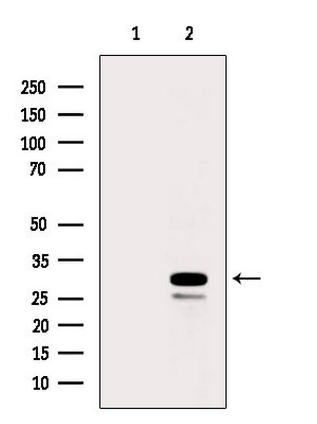 RPS8 Antibody in Western Blot (WB)