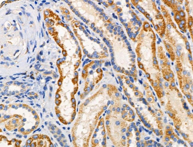 RPL10L Antibody in Immunohistochemistry (Paraffin) (IHC (P))