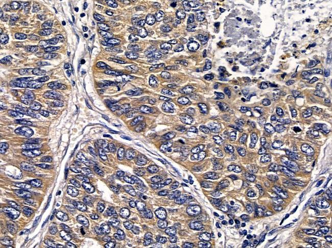 ABHDB Antibody in Immunohistochemistry (Paraffin) (IHC (P))