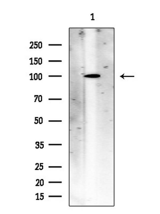 ACSS1 Antibody in Western Blot (WB)