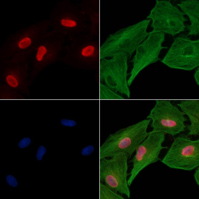 PHAPI2 Antibody in Immunocytochemistry (ICC/IF)